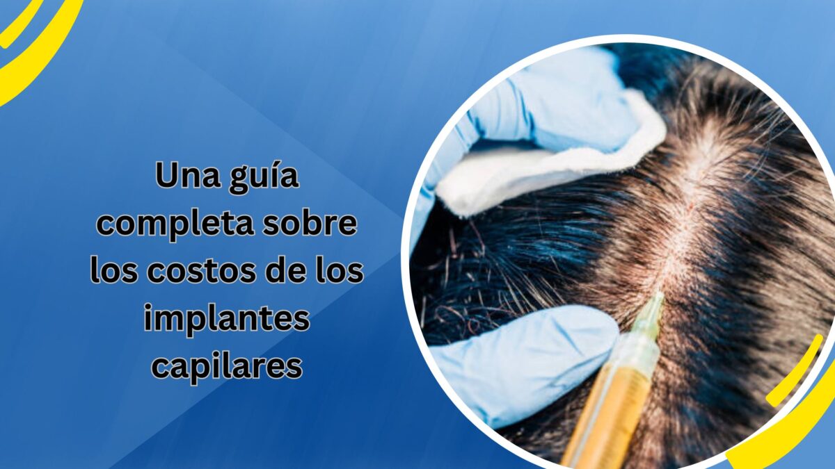 Una guía completa sobre los costos de los implantes capilares